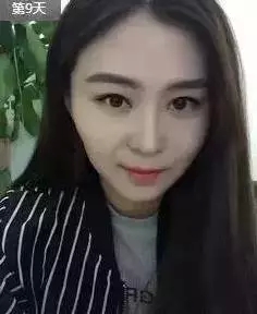 打B****Z长能保持多长时间 打B****前后果对比照片图
