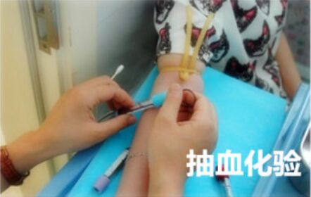 假体隆鼻手术后会变形吗 假体隆鼻取出后会变形吗