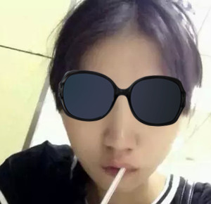 打完B****几天起 注射B****瘦脸后成好吗