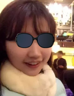 打完B****几天起 注射B****瘦脸后成好吗