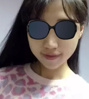 打完B****几天起 注射B****瘦脸后成好吗