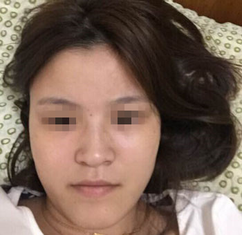 整成瓜子脸需要多少钱价格 整形瓜子脸需要多少钱价格 整个瓜子脸需要多少钱价格