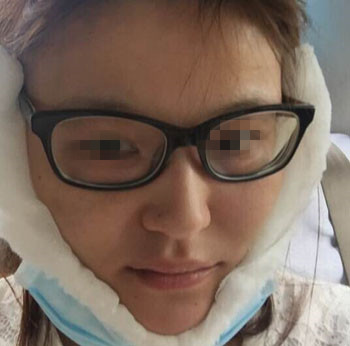 整成瓜子脸需要多少钱价格 整形瓜子脸需要多少钱价格 整个瓜子脸需要多少钱价格