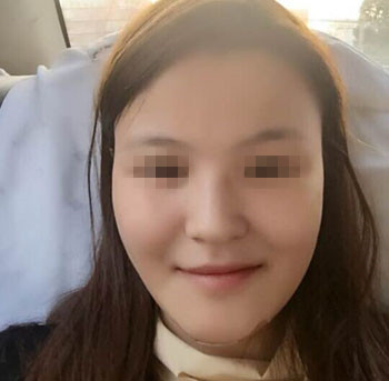 整成瓜子脸需要多少钱价格 整形瓜子脸需要多少钱价格 整个瓜子脸需要多少钱价格