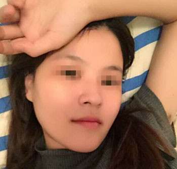 整成瓜子脸需要多少钱价格 整形瓜子脸需要多少钱价格 整个瓜子脸需要多少钱价格