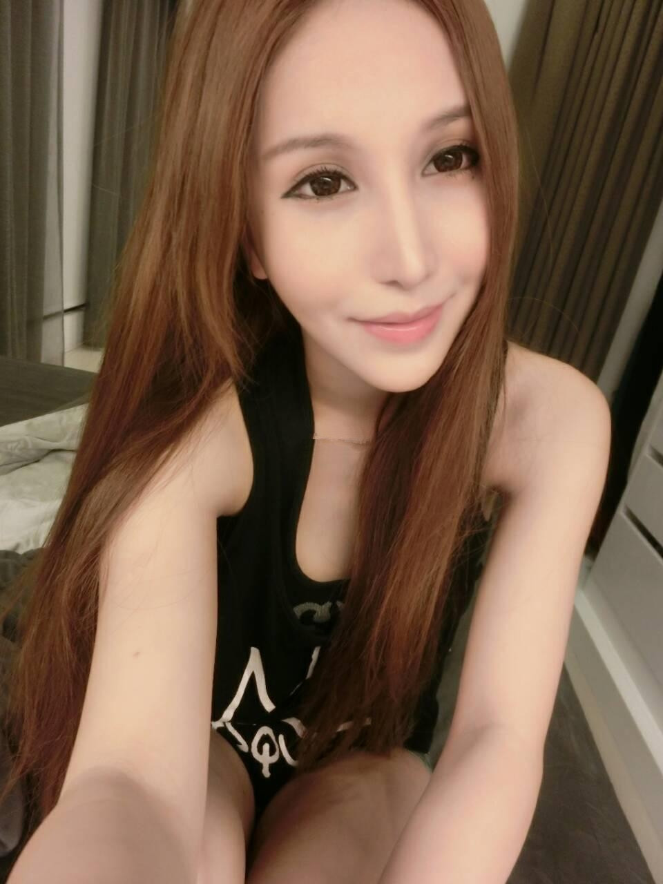 开内眼角手术成好吗 开内眼角手术前后对比图