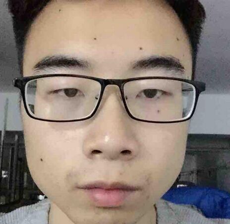 注射打注射瘦脸B****瘦脸的价格多少钱 注射打注射瘦脸除皱美容的价格多少钱