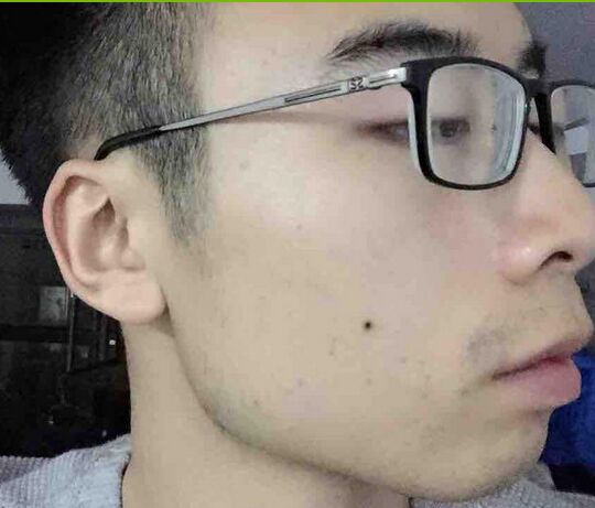 注射打注射瘦脸B****瘦脸的价格多少钱 注射打注射瘦脸除皱美容的价格多少钱