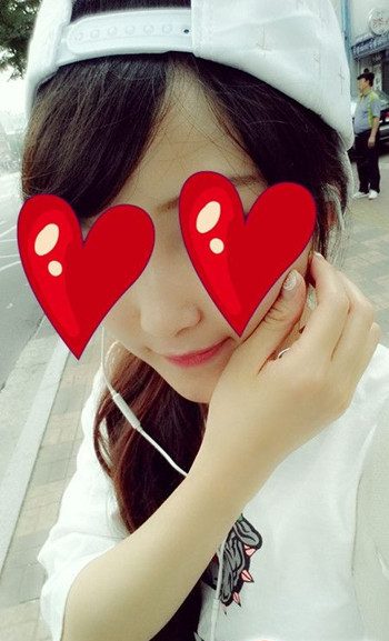 注射打玻尿酸隆鼻前后对比果照片图 注射打玻尿酸隆鼻可以能够维持多久