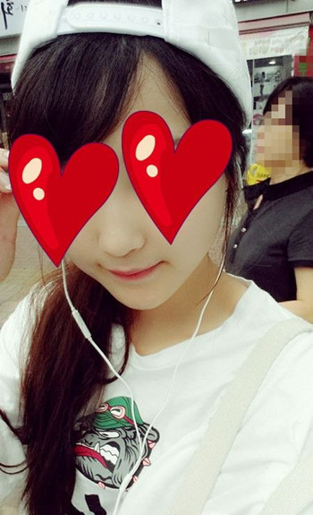 注射打玻尿酸隆鼻前后对比果照片图 注射打玻尿酸隆鼻可以能够维持多久