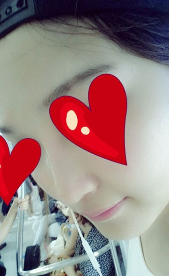 注射打玻尿酸隆鼻前后对比果照片图 注射打玻尿酸隆鼻可以能够维持多久