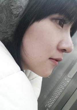 自体软骨隆鼻手术大概需要花多少钱价格 自体软骨隆鼻手术前后对比恢复过程果照片图