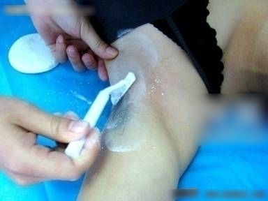 冰点e光脱毛的价格是多少钱 冰点e光脱毛的价格表