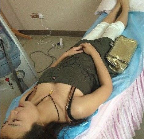 永.久性脱毛的价格大概是多少钱 冰点激光永.久脱毛价格表多少钱