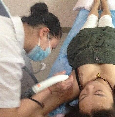 永.久性脱毛的价格大概是多少钱 冰点激光永.久脱毛价格表多少钱