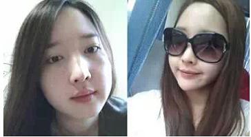 抽脂手术减肥大概要多少钱价格 抽脂减肥手术大概价格多少钱一览表