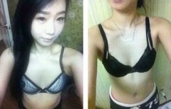 做硅胶假体隆胸手术降低风险吗 假体整形隆胸手术的价格表