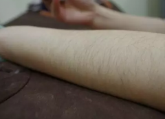 做腋下激光永.久脱毛大概一般多少钱价格 做冰点激光疼痛感较轻脱毛价格表多