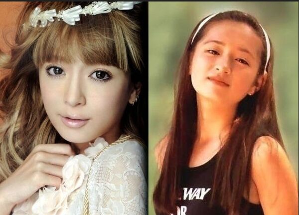 明星开眼角前后对比果照片案例图 开眼角手术的后遗症有哪些