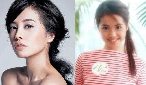 明星开眼角前后对比果照片案例图 开眼角手术的后遗症有哪些