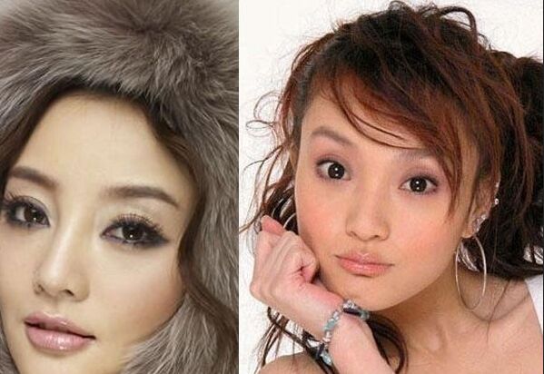 明星开眼角前后对比果照片案例图 开眼角手术的后遗症有哪些