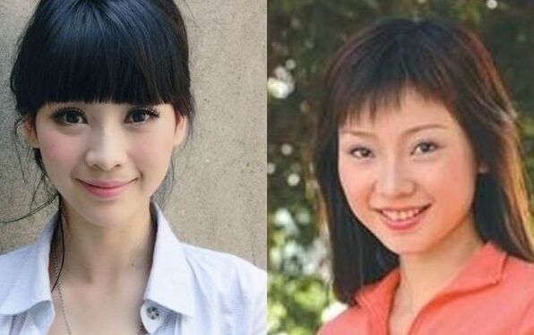 明星开眼角前后对比果照片案例图 开眼角手术的后遗症有哪些