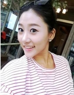 开眼角手术价钱多少钱 开眼角手术前后对比图