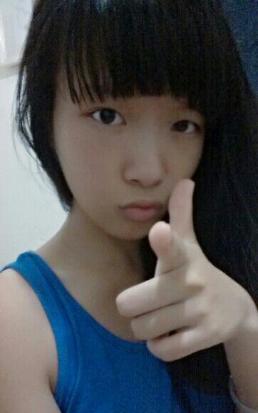 假体隆鼻手术一般大概能保持多久 假体隆鼻手术一般大概可以维持多久