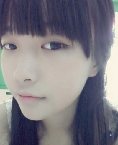 假体隆鼻手术一般大概能保持多久 假体隆鼻手术一般大概可以维持多久