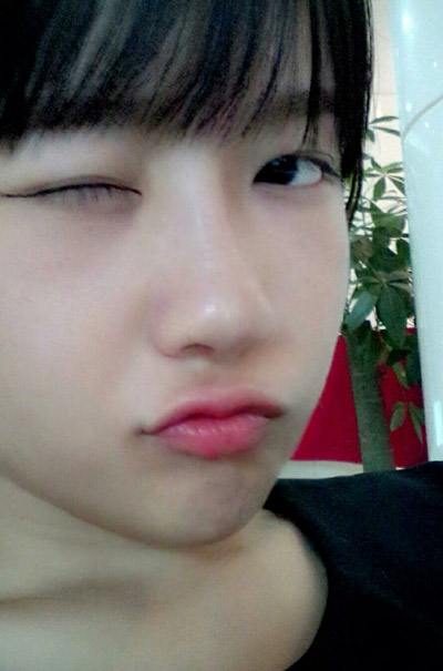 假体隆鼻手术一般大概能保持多久 假体隆鼻手术一般大概可以维持多久