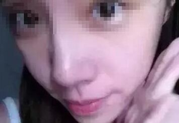 玻尿酸注射隆鼻法果大概一般能够维持多久 注射胶原蛋白隆鼻法果大概一般能够维持多久