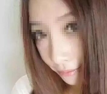 玻尿酸注射隆鼻法果大概一般能够维持多久 注射胶原蛋白隆鼻法果大概一般能够维持多久