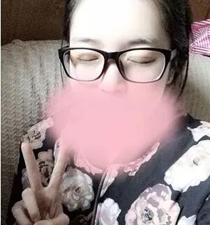 拉双眼皮手术有什么样的危害后遗症副作用 做双眼皮手术的副作用后遗症危害