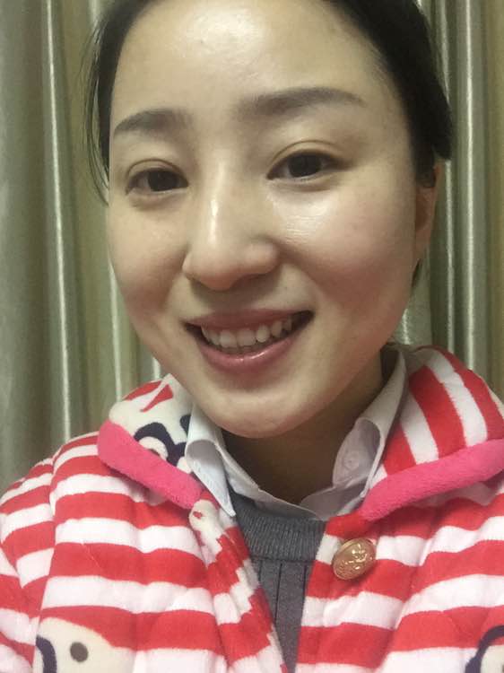 韩式六点定位双眼皮手术和微创定点定位双眼皮手术有什么区别