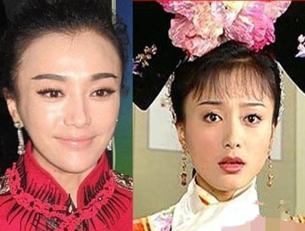 明星开眼角前后对比图片 看看哪些是人造大眼美女