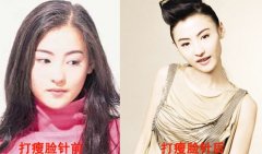 【B****前后对比图】揭秘娱乐圈女星打B****前后对比图