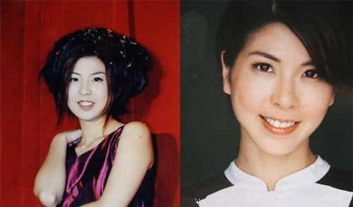 【B****前后对比图】揭秘娱乐圈女星打B****前后对比图