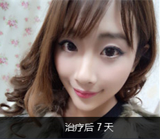 上海天大医疗美容医院明慧激光嫩肤果好不好