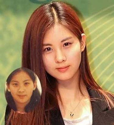 【金鱼眼整形】少女时代徐贤旧照曝光 金鱼眼整形变芭比大眼