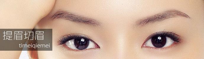 切眉术有哪些注意事项 切眉术前后对比图