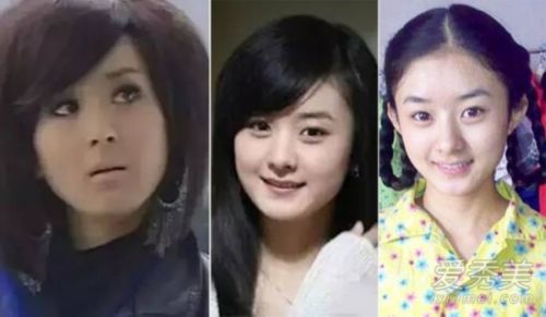注射B****的后遗症有哪些 注射打B****的副作用大吗