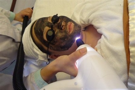 做黑脸娃娃成好吗黑脸娃娃要做几次才能变白