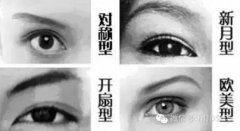 内双适合做哪种双眼皮手术果好