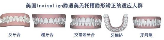 杭州牙齿矫正一般需要多少钱?价格?