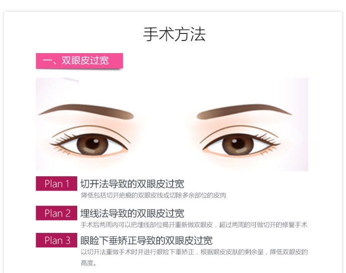 双眼皮失败怎么能修复成单眼皮 修复失败双眼皮的新方法