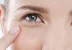 怎样去除鱼尾纹 鱼尾纹怎么去除