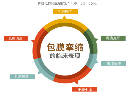 假体隆胸后出现包膜挛缩是怎么回事
