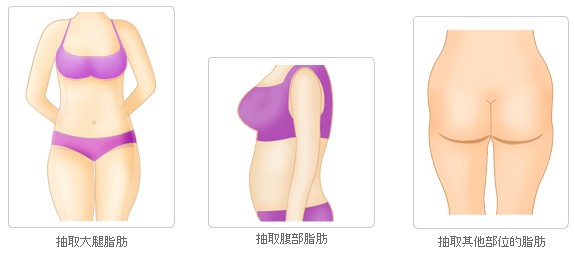 韩国BK整形医院隆胸手术要多少钱?降低风险吗?