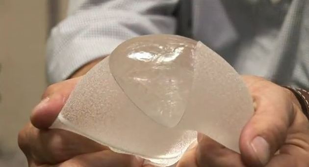 重庆华美整形医院假体隆胸手术需要多少钱?果自然吗?