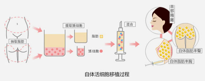 如何让自己乳房变大 怎样才能让胸部变大
